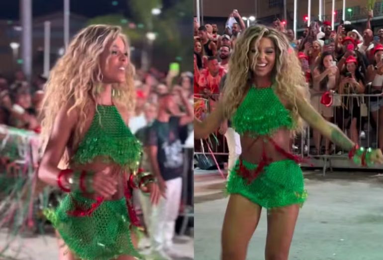 Brunna Gonçalves brinca sobre voltar a sambar 26 dias após cirurgia